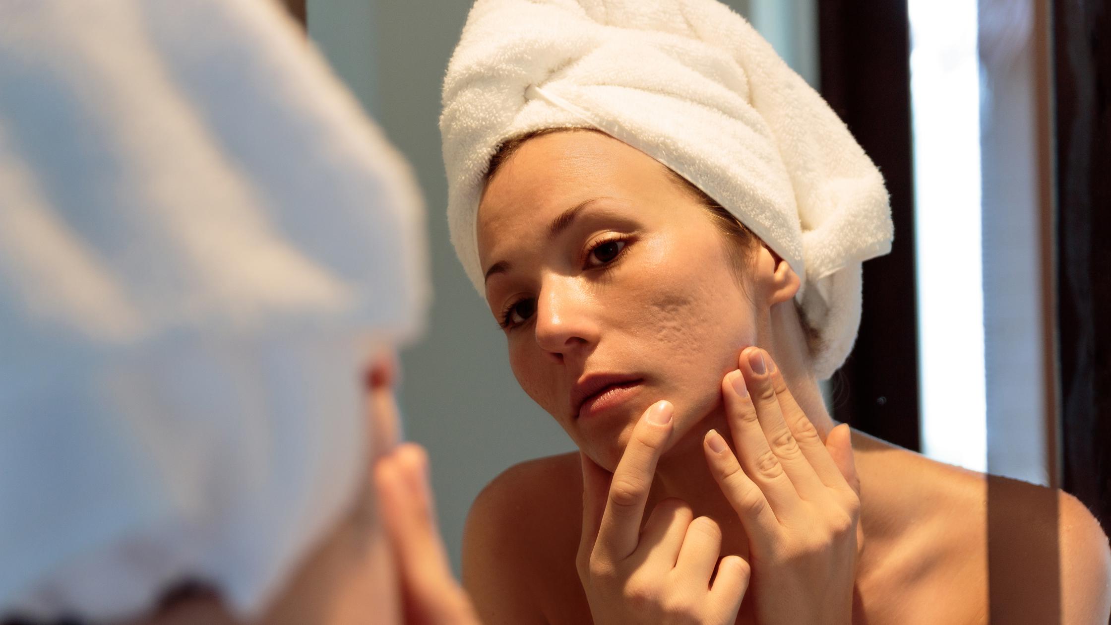 How can I Heal My Skin so It Doesn’t Scar? - a Guide to Wound Healing that is Esthetician Approved